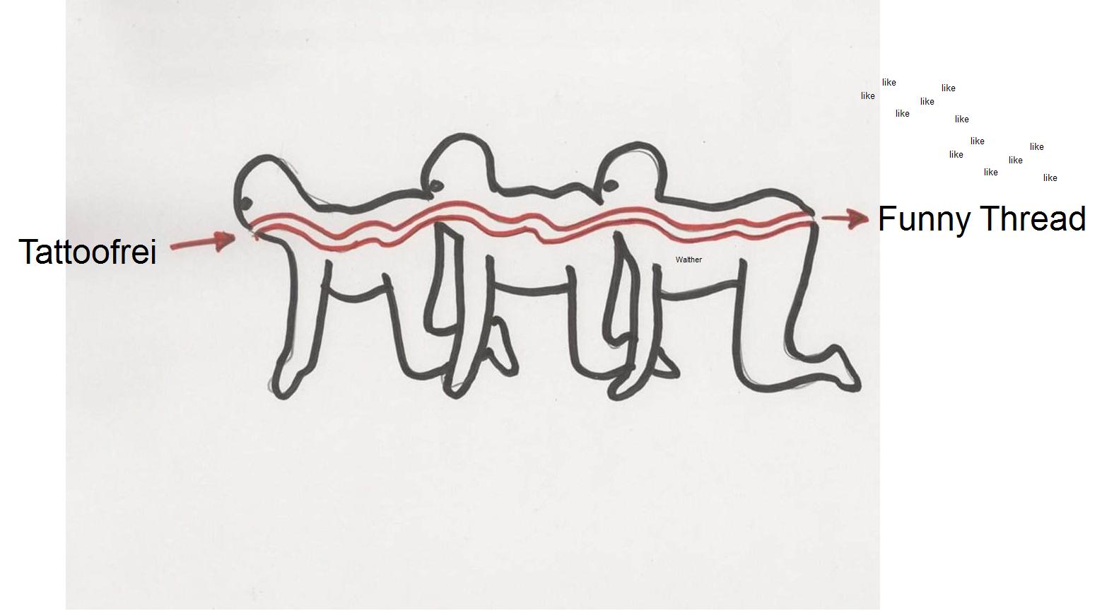 Surgery_diagram.jpg