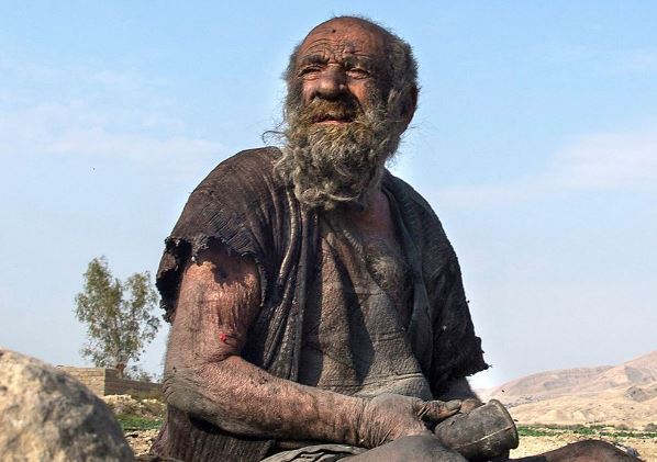Worlds-dirtiest-man-dies-at-94-after-first-bath-in-over-60-years.jpg