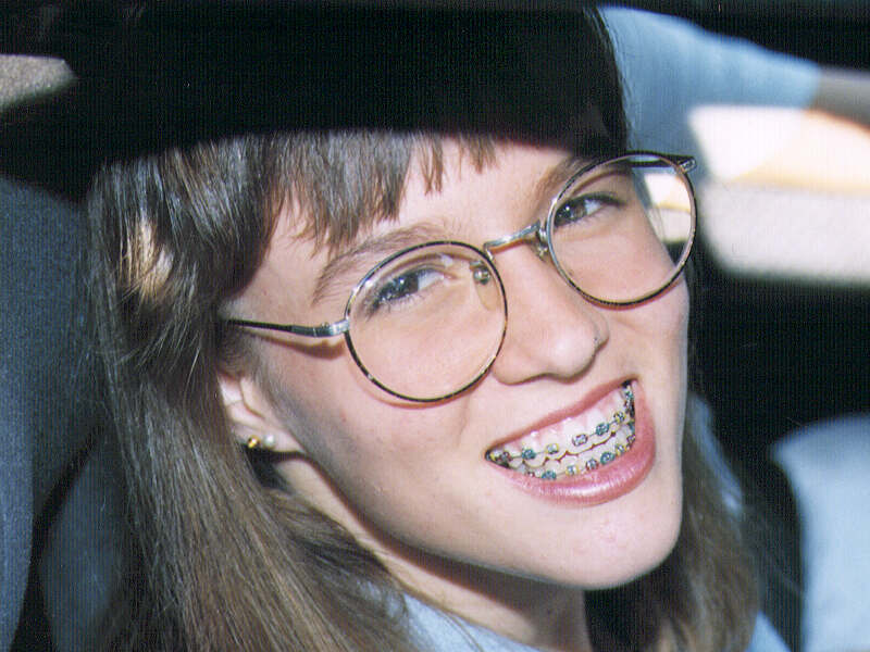 braces.jpg