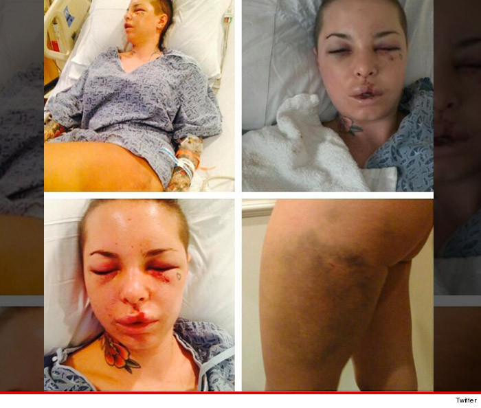 0811-christy-mack-injuries-twitter-7.jpg