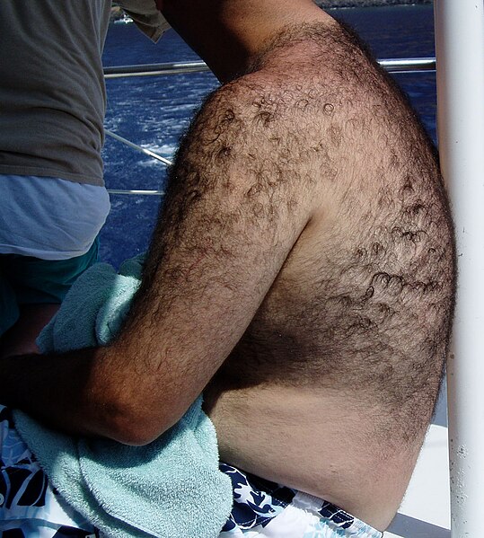 539px-Backhair.jpg